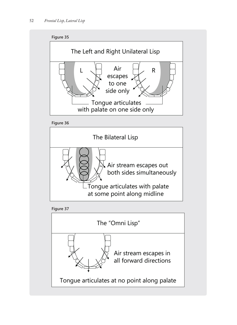 How Are Lisps Diagnosed and Treated?